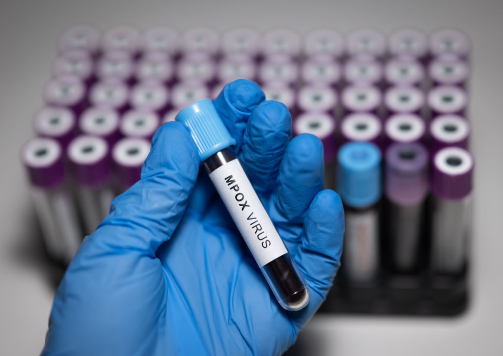 rssimg_68dd09b37712a