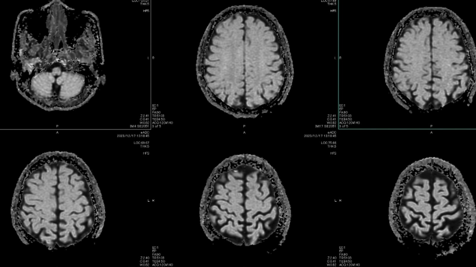 rssimg_69a865151220e